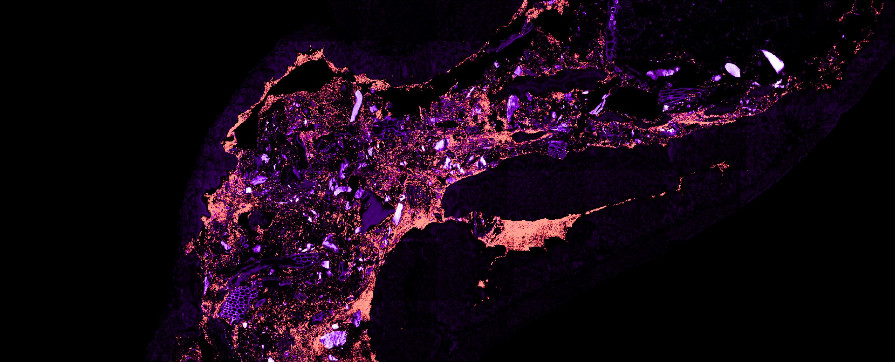 A mouse colon slide illuminating the difference between the host and microbiome in pink and purple