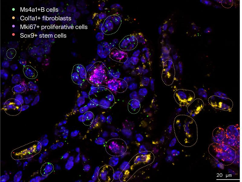 A slide of HiPR-Fish mapping technology mapping of microbiome & measuring host transcriptome in situ. The different elements of the immune cell interaction are circled, highlighting B cells, fibroblasts, proliferative cells, and stem cells.